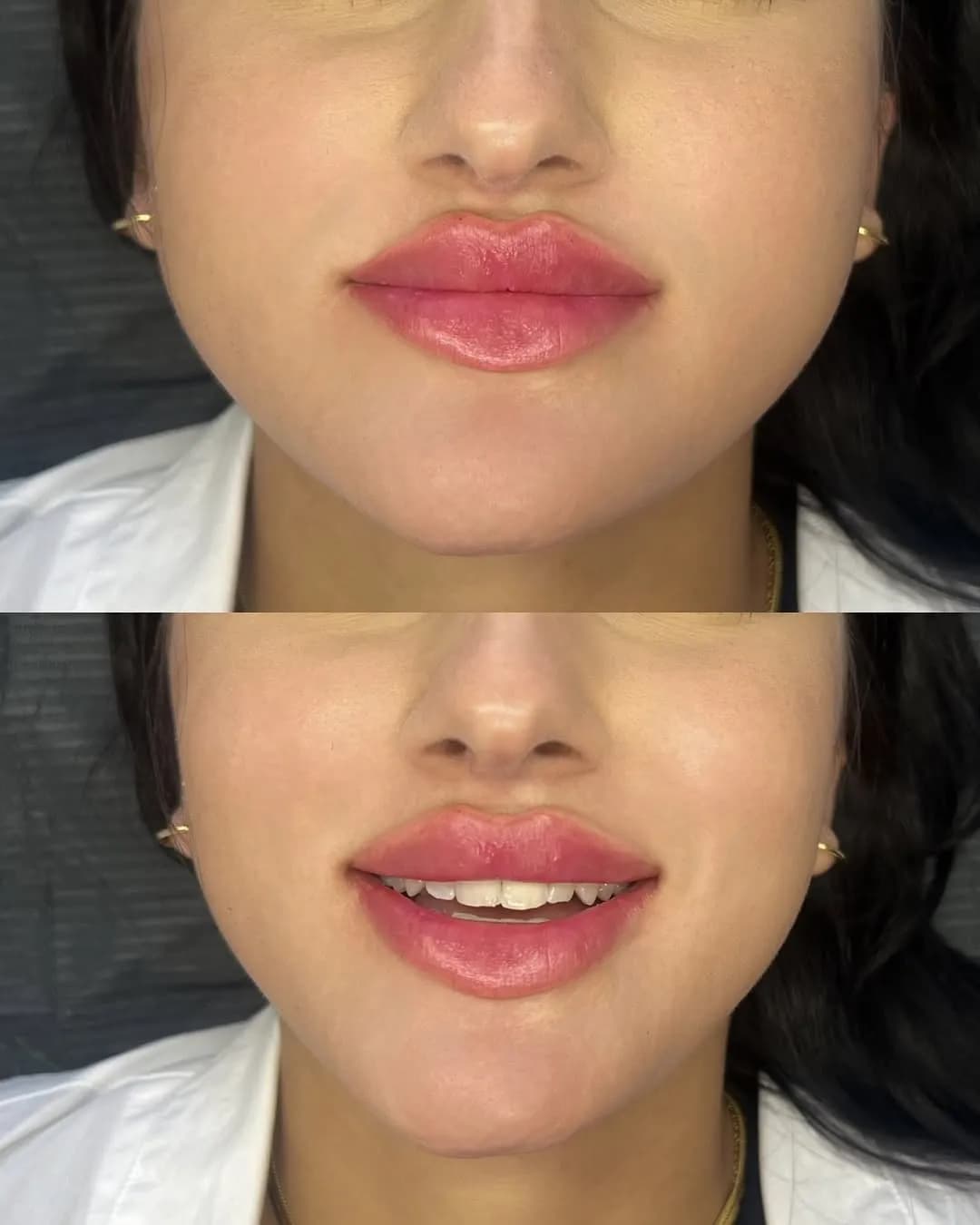 CC Lips — natural volume and harmonious shape