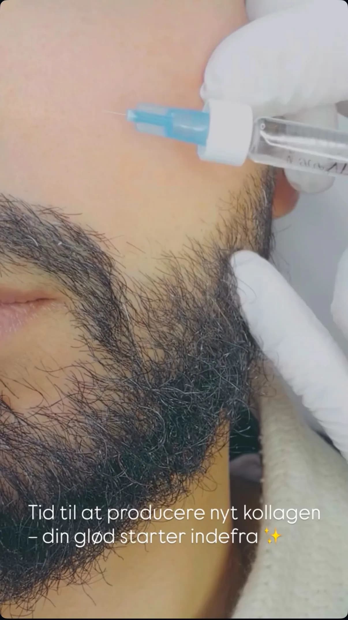 Skinbooster — what is it, and what can it do for your skin?